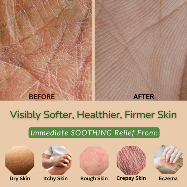 Lemongrass Body Lotion | Aloe & Olive Hand & Body Lotion for Dry Skin Relief - Organic