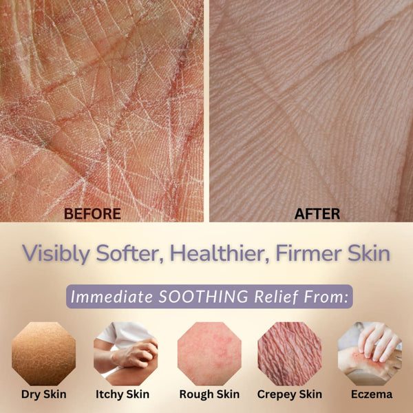 Lavender Body Lotion & Hand Cream | Best Moisturizer for Dry Skin Flaky Skin Itchy Skin