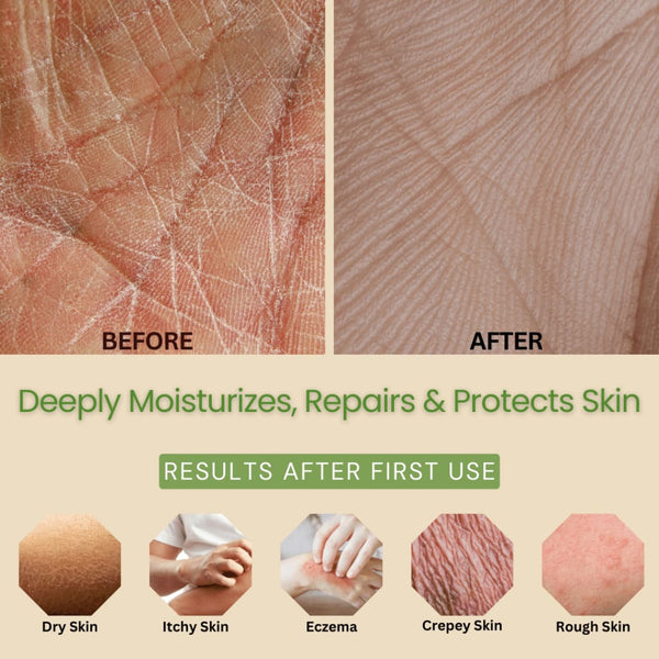 Aloe & Olive Hand & Body Lotion with Lemongrass Oil - Organic Skin Care