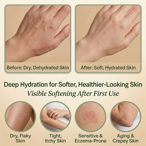 Lemongrass hand and body lotion before and after results showing deep hydration, softer skin, smoother texture, and healthy-looking skin